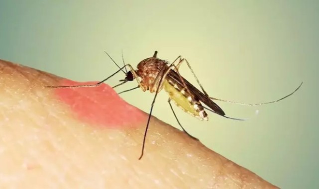 Sivrisinek ısırığı kaşıntısı nasıl geçer? Ne iyi gelir?