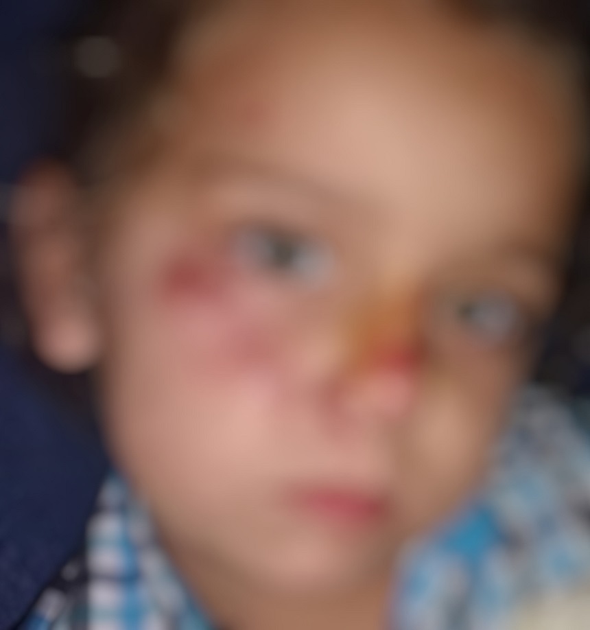 Sırtından ısırdığı çocuğu yüz üstü sürükledi;