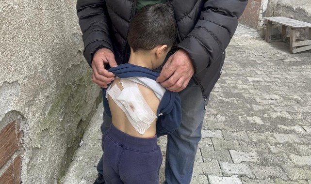 Kastamonu'da sokak köpeği, çocuğa saldırdı;