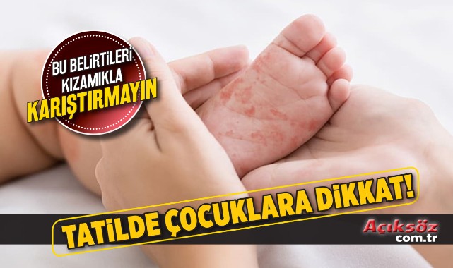 Çocuklarda artan el-ayak, ağız hastalığına dikkat!;