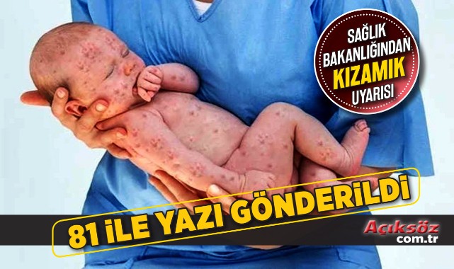 Sağlık Bakanlığından 'kızamık' genelgesi!;