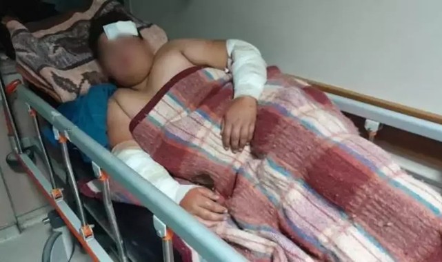 Sokak köpeklerinin kovaladığı çocuk yaralandı;